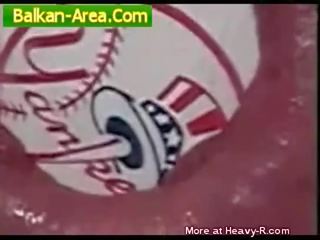 MD anal stretching